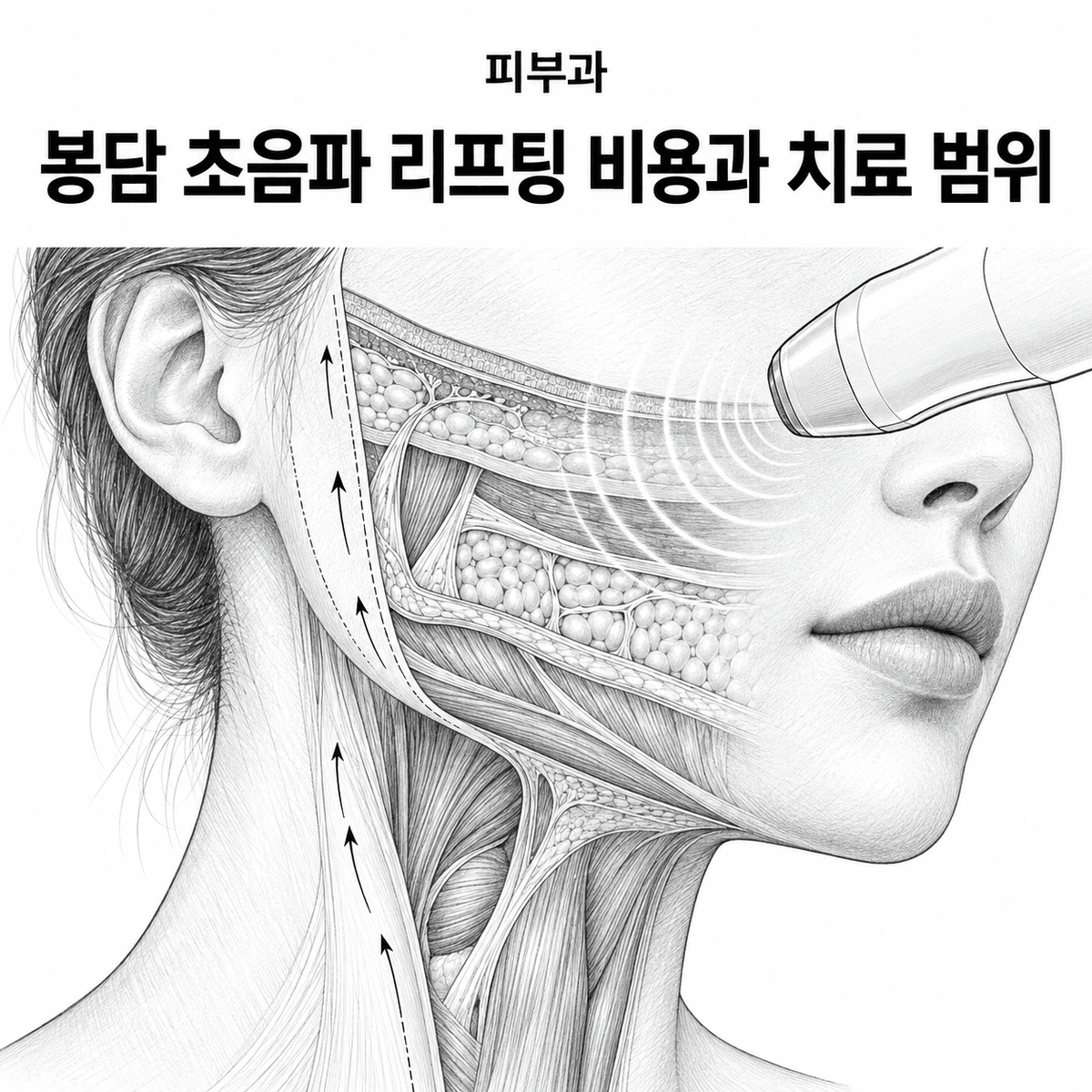 경기도 화성시 피부과 봉담 초음파 리프팅 비용과 치료 범위 핵심 정보 이미지