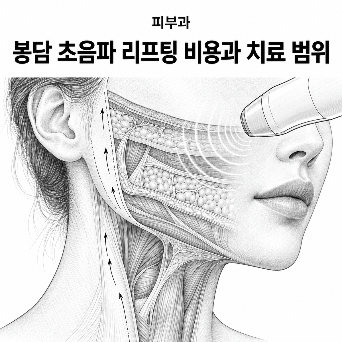 경기도 화성시 피부과 봉담 초음파 리프팅 비용과 치료 범위 핵심 정보 이미지